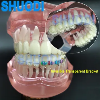 Стоматологическая модель зуба с невидимым прозрачным кронштейном Ортодонтическая модель для общения с пациентом Стоматологический кабинет Модель зубов